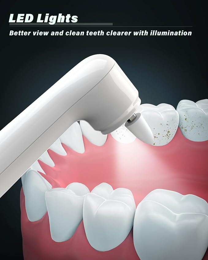 Tooth Polisher, Rechargeable Tooth Whitening Kit - Image 7