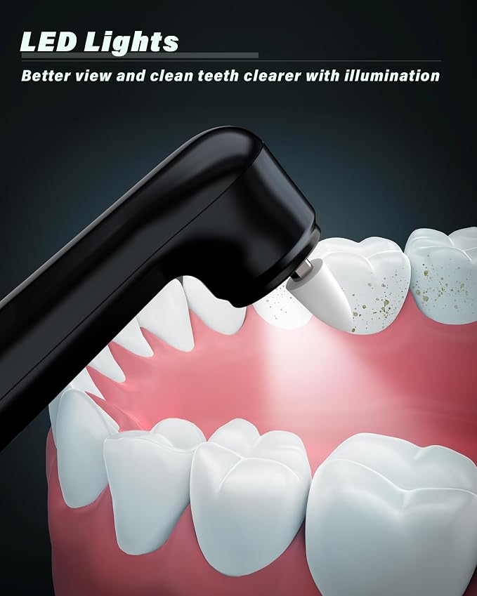 Tooth Polisher, Rechargeable Tooth Whitening Kit - Image 7