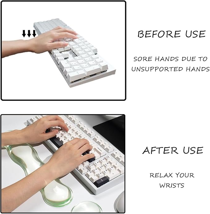 Clear Gel Wrist Rest for Keyboard and Mouse, Cute Ergonomic Wrist Rest for - Image 5