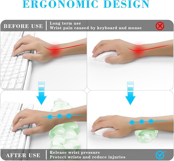 Gel Cloud Keyboard and Mouse Wrist Rest, Cute Wrist Support and Arm Support - Image 2