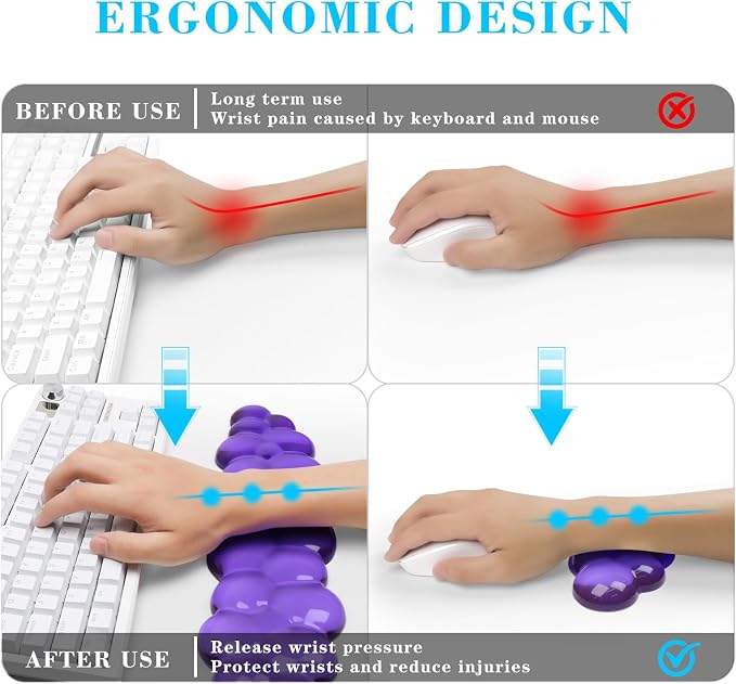 Gel Cloud Keyboard and Mouse Wrist Rest, Cute Wrist Support and Arm Support - Image 2
