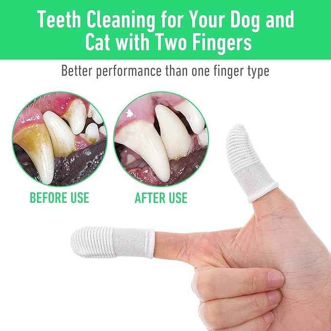 YUIANLB 20 Pcs Pet Dental Care Kit Finger Toothbrush Oral Cleaning Wipes Soft - Image 4