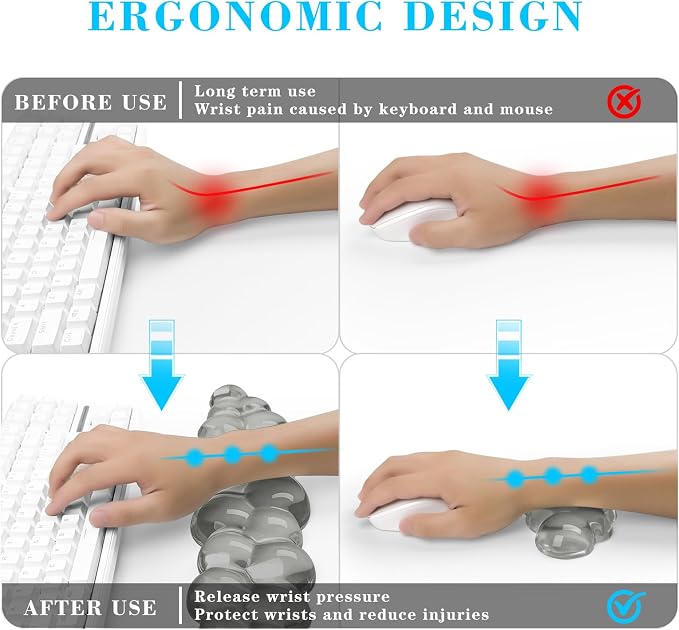 Gel Cloud Keyboard and Mouse Wrist Rest, Cute Wrist Support and Arm Support - Image 2