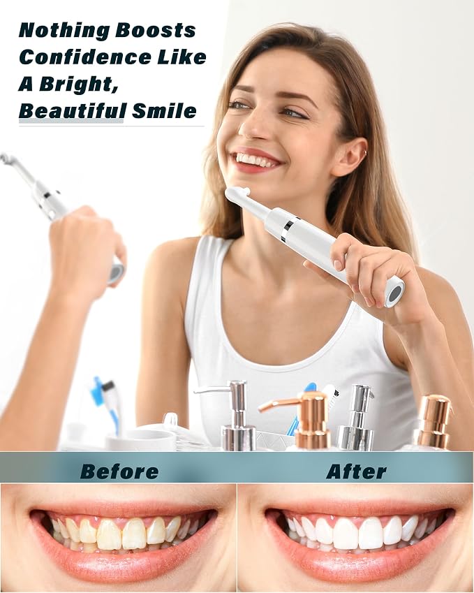 Tooth Polisher, Rechargeable Tooth Whitening Kit - Image 5