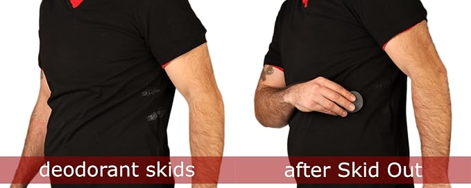 Stain Treater and Spot Remover Sponges - Image 4