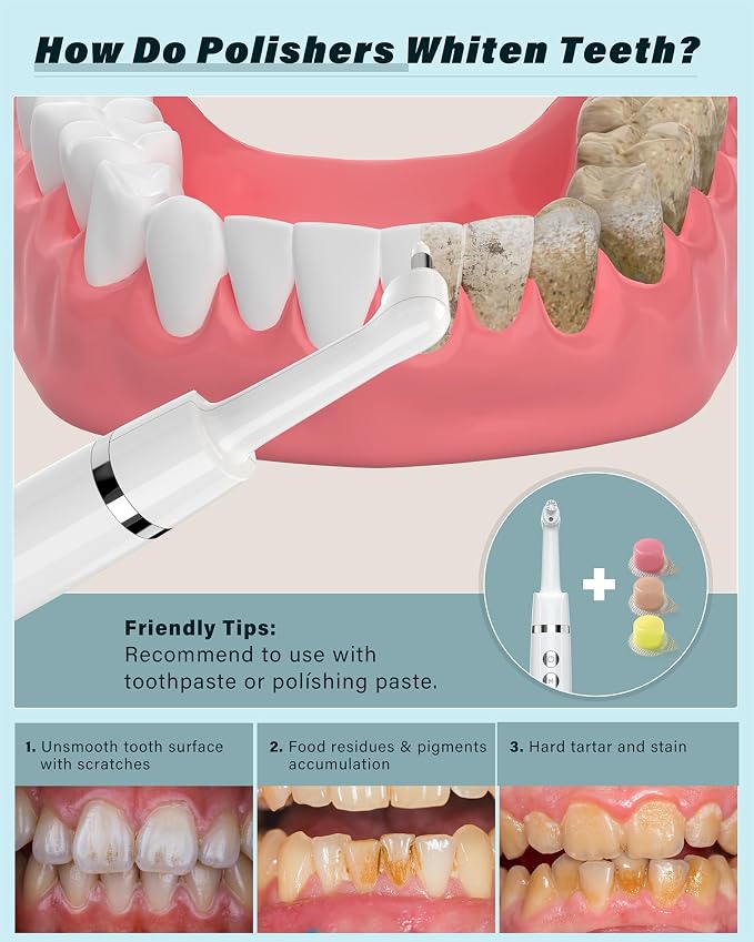 Tooth Polisher, Rechargeable Tooth Whitening Kit - Image 2